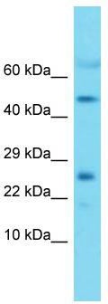 Host: Rabbit; Target Name: Mrpl22; Sample Tissue: Mouse Heart lysates; Antibody Dilution: 1.0 ug/ml