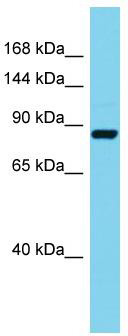 Host: Rabbit; Target Name: Stim2; Sample Tissue: Mouse Pancreas lysates; Antibody Dilution: 1.0 ug/ml