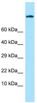 WB Suggested Anti-EMR1 Antibody; Titration: 1.0 ug/ml; Positive Control: HepG2 Whole Cell