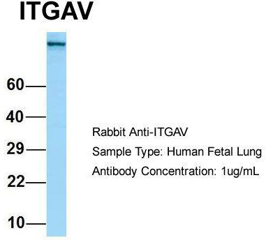Host: Rabbit; Target Name: ITGAV; Sample Tissue: Human Fetal Lung; Antibody Dilution: 1.0 ug/ml