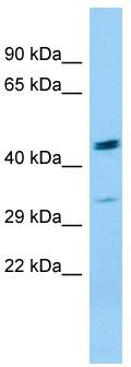 Host: Rabbit; Target Name: BDKRB1; Sample Tissue: THP-1 Whole Cell lysates; Antibody Dilution: 1.0 ug/ml