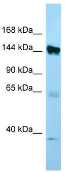 WB Suggested Anti-EMILIN1 Antibody; Titration: 1.0 ug/ml; Positive Control: MCF7 Whole Cell