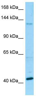 WB Suggested Anti-BMS1 Antibody; Titration: 1.0 ug/ml; Positive Control: Fetal Kidney