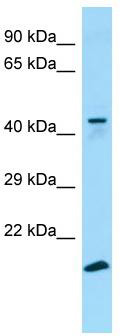 WB Suggested Anti-GPR34 Antibody; Titration: 1.0 ug/ml; Positive Control: 293T Whole Cell