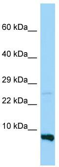 WB Suggested Anti-RPS28 Antibody; Titration: 1.0 ug/ml; Positive Control: MDA-MB-435S Whole Cell RPS28 is strongly supported by BioGPS gene expression data to be expressed in Human MDA-MB435 cells