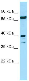 WB Suggested Anti-EIF2B2 Antibody; Titration: 1.0 ug/ml; Positive Control: 293T Whole Cell EIF2B2 is supported by BioGPS gene expression data to be expressed in HEK293T