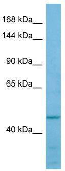 Host: Rabbit; Target Name: FMNL2; Sample Tissue: OVCAR-3 Whole Cell lysates; Antibody Dilution: 1.0 ug/ml