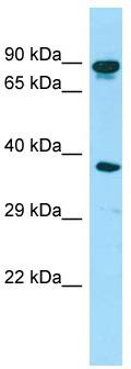 WB Suggested Anti-HOOK3 Antibody; Titration: 1.0 ug/ml; Positive Control: Fetal Heart