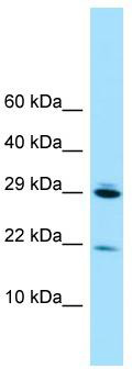 WB Suggested Anti-RPL28 Antibody; Titration: 1.0 ug/ml; Positive Control: 293T Whole Cell RPL28 is supported by BioGPS gene expression data to be expressed in HEK293T