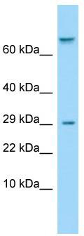 Host: Rabbit; Target Name: TAS1R1; Sample Tissue: ACHN Whole Cell lysates; Antibody Dilution: 1.0 ug/ml