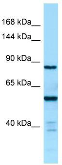 WB Suggested Anti-CTDP1 Antibody; Titration: 1.0 ug/ml; Positive Control: Fetal kidney