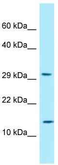 WB Suggested Anti-RPLP2 Antibody; Titration: 1.0 ug/ml; Positive Control: OVCAR-3 Whole Cell RPLP2 is strongly supported by BioGPS gene expression data to be expressed in Human OVCAR3 cells