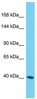 Host: Rabbit; Target Name: SAMD9L; Sample Tissue: HepG2 Whole Cell lysates; Antibody Dilution: 1.0 ug/ml