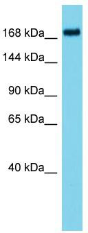 Host: Rabbit; Target Name: ATAD2B; Sample Tissue: HT1080 Whole Cell lysates; Antibody Dilution: 1.0ug/ml