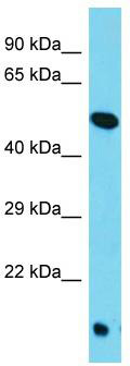 Host: Rabbit; Target Name: TOR4A; Sample Tissue: HepG2 Whole Cell lysates; Antibody Dilution: 1.0ug/ml; TOR4A is supported by BioGPS gene expression data to be expressed in HepG2