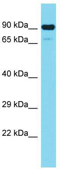 Host: Rabbit; Target Name: CEP89; Sample Tissue: Jurkat Whole Cell lysates; Antibody Dilution: 1.0 ug/ml.