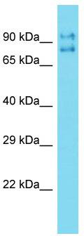 Host: Rabbit; Target Name: Tigd5; Sample Tissue: Mouse Liver lysates; Antibody Dilution: 1.0 ug/ml.