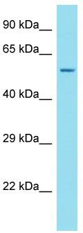 Host: Rabbit; Target Name: ANKRD34C; Sample Tissue: OVCAR-3 Whole Cell lysates; Antibody Dilution: 1.0 ug/ml; ANKRD34C is supported by BioGPS gene expression data to be expressed in OVCAR3