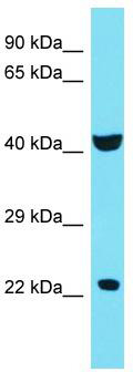 Host: Rabbit; Target Name: C4orf51; Sample Tissue: 721_B Whole Cell lysates; Antibody Dilution: 1.0 ug/ml