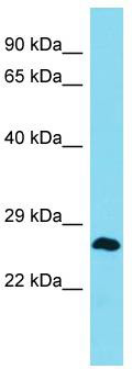 Host: Rabbit; Target Name: MLLT4-AS1; Sample Tissue: Jurkat Whole Cell lysates; Antibody Dilution: 1.0 ug/ml