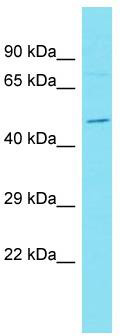 Host: Rabbit; Target Name: DUX4L4; Sample Tissue: ACHN Whole Cell lysates; Antibody Dilution: 1.0 ug/ml