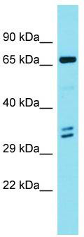 Host: Rabbit; Target Name: ENO4; Sample Tissue: 721_B Whole Cell lysates; Antibody Dilution: 1.0 ug/ml