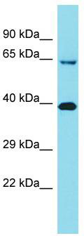 Host: Rabbit; Target Name: KIAA2013; Sample Tissue: Placenta lysates; Antibody Dilution: 1.0 ug/ml