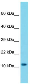 Host: Rabbit; Target Name: MRPS25; Sample Tissue: A549 Whole Cell lysates; Antibody Dilution: 1.0 ug/ml