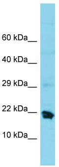 Host: Rabbit; Target Name: MRPS25; Sample Tissue: U937 Whole Cell lysates; Antibody Dilution: 1.0 ug/ml