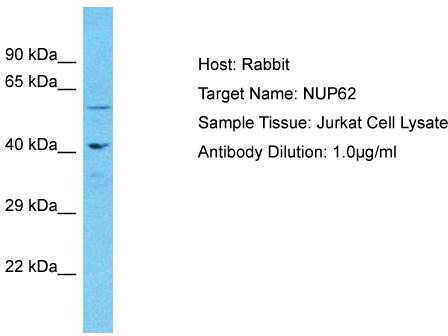 Host: Rabbit; Target Name: NUP62; Sample Tissue: Jurkat Whole Cell lysates; Antibody Dilution: 1.0 ug/ml; NUP62 is strongly supported by BioGPS gene expression data to be expressed in Human Jurkat cells