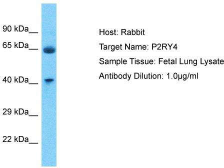 Host: Rabbit; Target Name: P2RY4; Sample Tissue: Fetal Lung lysates; Antibody Dilution: 1.0ug/ml
