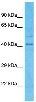 Host: Rabbit; Target Name: TRIM16L; Sample Tissue: Fetal Lung lysates; Antibody Dilution: 1.0ug/ml