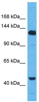 Host: Rabbit; Target Name: WWC2; Sample Tissue: MCF7 Whole Cell lysates; Antibody Dilution: 1.0ug/ml