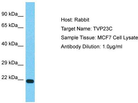 Host: Rabbit; Target Name: TVP23C; Sample Tissue: MCF7 Whole Cell lysates; Antibody Dilution: 1.0ug/ml