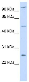 WB Suggested Anti-TRAF4 Antibody Titration: 0.2-1 ug/ml; ELISA Titer: 1:62500; Positive Control: Hela cell lysate TRAF4 is supported by BioGPS gene expression data to be expressed in HeLa