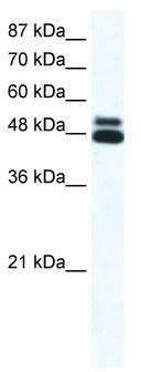 WB Suggested Anti-CHRNB2 Antibody Titration: 0.2-1 ug/ml; ELISA Titer: 1:62500; Positive Control: HepG2 cell lysate