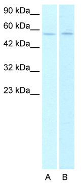 Host: Rabbit; Target Name: CHRNA2 Lane A: HepG2 cell lysates Lane B: Raji cell lysates; Antibody Dilution: 0.5ug/ml