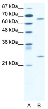 WB Suggested Anti-FOXK2 Antibody Titration: 2.5ug/ml; ELISA Titer: 1:62500; Positive Control: Jurkat cell lysate