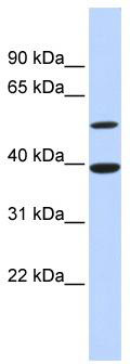 WB Suggested Anti-ATF7 Antibody Titration: 0.2-1 ug/ml; ELISA Titer: 1:1562500; Positive Control: Human heart