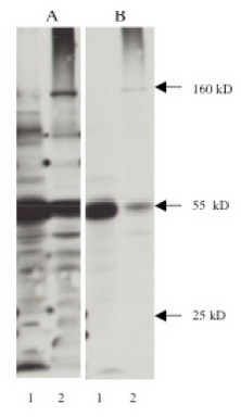 Legend A. Western blot using 3-nitrotyrosine monoclonal antibody on 40 g mouse brain lysate (Lane 1) and 40 g rat brain lysate (Lane 2). Antibody used at a dilution of 1g/ml, detected with Supersignal West Pico Substrate -30 second exposure. Legend B. Same