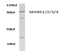 Western blot analysis of MARK1/2/3/4 antibody Cat.-No AP01363PU-Nin extracts from A549 cells.