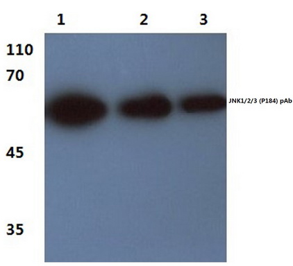 Western blot (WB) analysis of JNK1/2/3 antibody (Cat.-No.: AP06530PU-N) at 1/500 dilution <span style=""text-decoration: underline;"">Lane 1</span>:THP1 whole cell lysate <span style=""text-decoration: underline;"">Lane 2</span>:Mouse