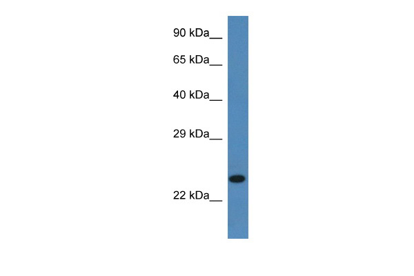Mouse Pancreas; WB Suggested Anti-Ssr2 Antibody. Titration: 1.0 ug/ml. Positive Control: Mouse Pancreas; Ssr2 antibody - C-terminal region (AP46044PU-N) in Mouse Pancreas cells using Western Blot