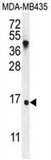 IGKV A18 Antibody (C-term) (Cat. #AP52172PU-N) western blot analysis in MDA-MB435 cell line lysates (35g/lane).This demonstrates the IGKVA18 antibody detected the IGKVA18 protein (arrow).</span>