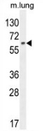 Western blot analysis in mouse lung tissue lysates (35ug/lane) using NFE2L1 antibody. (C-term). This demonstrates this antibody detected the NFE2L1 protein (arrow).
