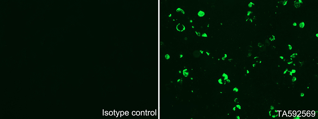 Immunofluorescent staining of  293T cells transfected by human CTAG1B plasmid([RC213318]) using anti-DDK antibody (TA592569/green, right), compared to an Isotype control(Left).(1:400)