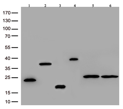 Immunoblot analysis of  picked 6 different DDK tagged overexpression lysates with TA592569 at 1:3000.(Lane 1/2 N-terminal DDK  tag;Lane 3/4 C-terminal 3XDDK tag; Lane 5/6 N-terminal 3XDDK tag.)