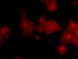 Cos7 cells transiently transfected with turboGFP tagged BID ORF cDNA clone ([RC100007]) for mitochondria marking were immuno-stained with OriGene 2H8 anti-turboGFP antibody (TA150041, 1:100), and then stained red with an Alexa-568 conjugated secondary antibody (1:1000).