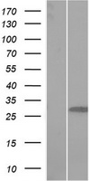Immunoprecipitation (IP) of recombinant tGFP fusion protein from overexpression lysate made with HEK293T cells transfected by plasmid expressing tGFP-DDK. The immunoprecipitated tGFP fusion protein was analyzed by immunoblot with rabbit anti-DDK polyclonal antibody. (Left lane: Negative control, IP without adding TA150041)