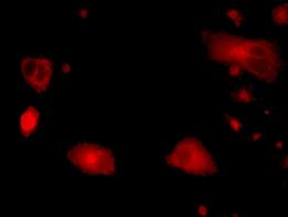 Cos7 cells transiently transfected with turboGFP tagged LAMP1 ORF cDNA clone ([RC100016]) for lysosome marking were immuno-stained with OriGene 2H8 anti-turboGFP antibody (TA150041, 1:100), and then stained red with an Alexa-568 conjugated secondary antibody (1:1000).